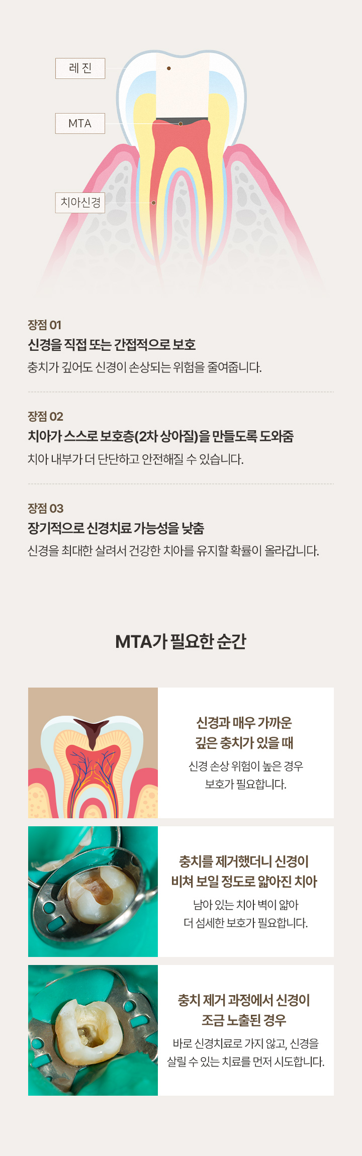 MTA