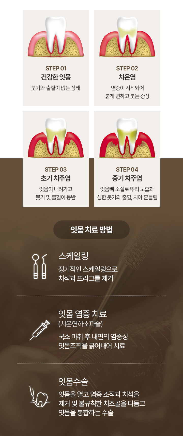 잇몸치료