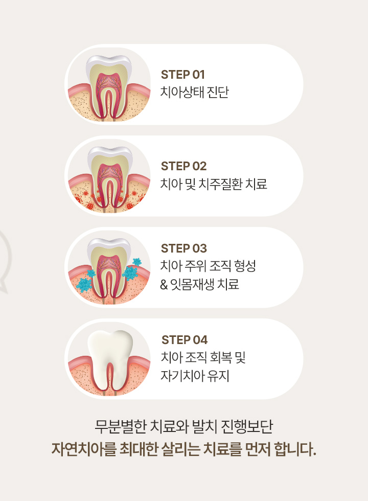 큐레이 뷰
